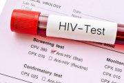Governo Bolsonaro suspende exames de HIV e hepatites no SUS