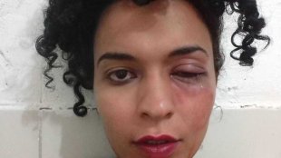 Aluna trans é agredida depois de evento LGBT na Universidade Federal de Pernambuco