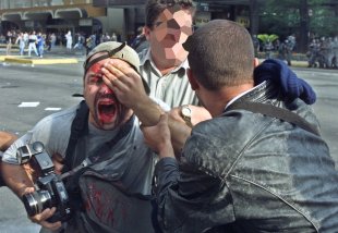 Fotógrafo que perdeu visão por tiro da polícia em manifestação espera há 20 anos por indenização