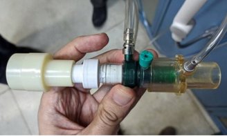 Pesquisadores da Coppe-UFRJ desenvolvem ventilador pulmonar mecânico que pode ser produzido em massa