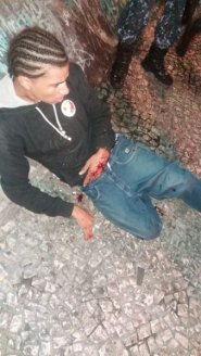 Absurdo: candidato do PT no PR é alvejado com bala de borracha pela polícia em Curitiba