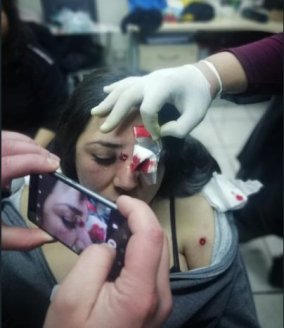 Todo repudio a repressão policial que baleou uma estudante da Universidade Iberoamericana no Chile