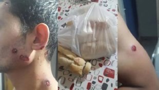 La Pampa (Argentina): Saiu pra comprar pão, a polícia o baleou e terminou hospitalizado