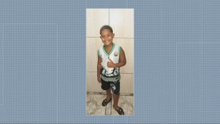 Menino de 8 anos é atingido na cabeça por bala perdida no Rio e segue hospitalizado