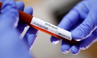 Falta de testes massivos facilitou disseminação de vírus na China e mortes na Itália
