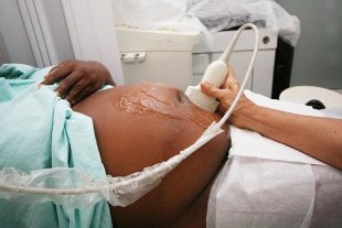 Durante 2020, morreram 78% mais mulheres negras grávidas do que mulheres brancas por Covid