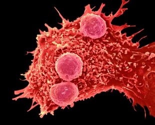 Avanços científicos no combate ao câncer - uma discussão sobre ciência e saúde
