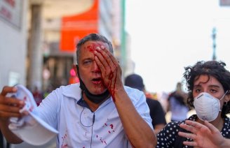 Trabalhador deve perder a visão após repressão da polícia de Paulo Câmara no ato em Recife