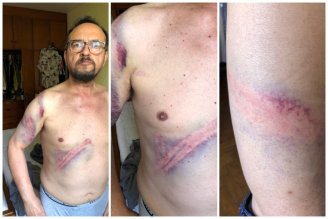 ABSURDO: professor aposentado de 64 anos é agredido na Alesp pela PM violenta de Doria