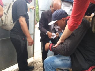 Professor leva bala de borracha na boca em protesto na ALESP contra reforma da previdência de Doria